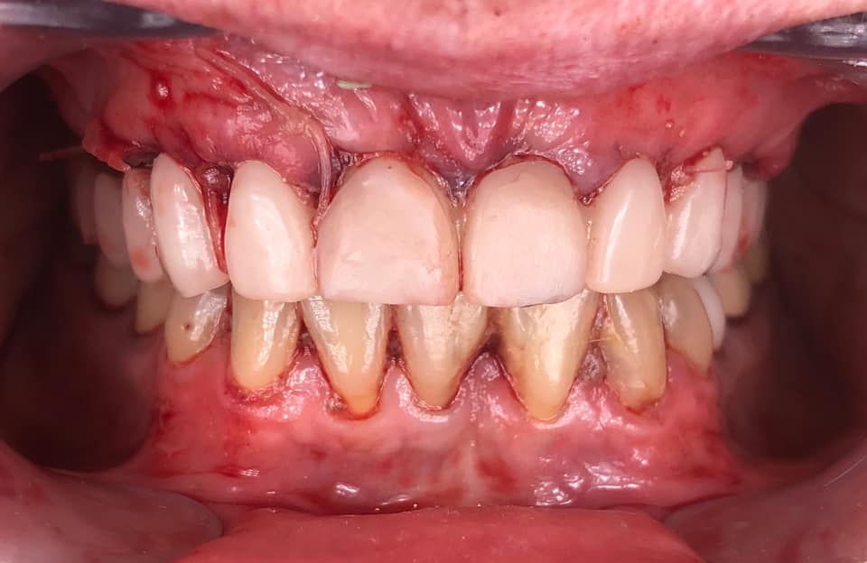 110031770_10105224490910711_421506169104139831_n