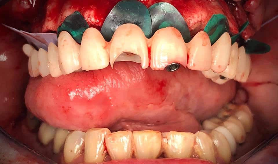 114870878_10105224299539221_6809837578651133316_n