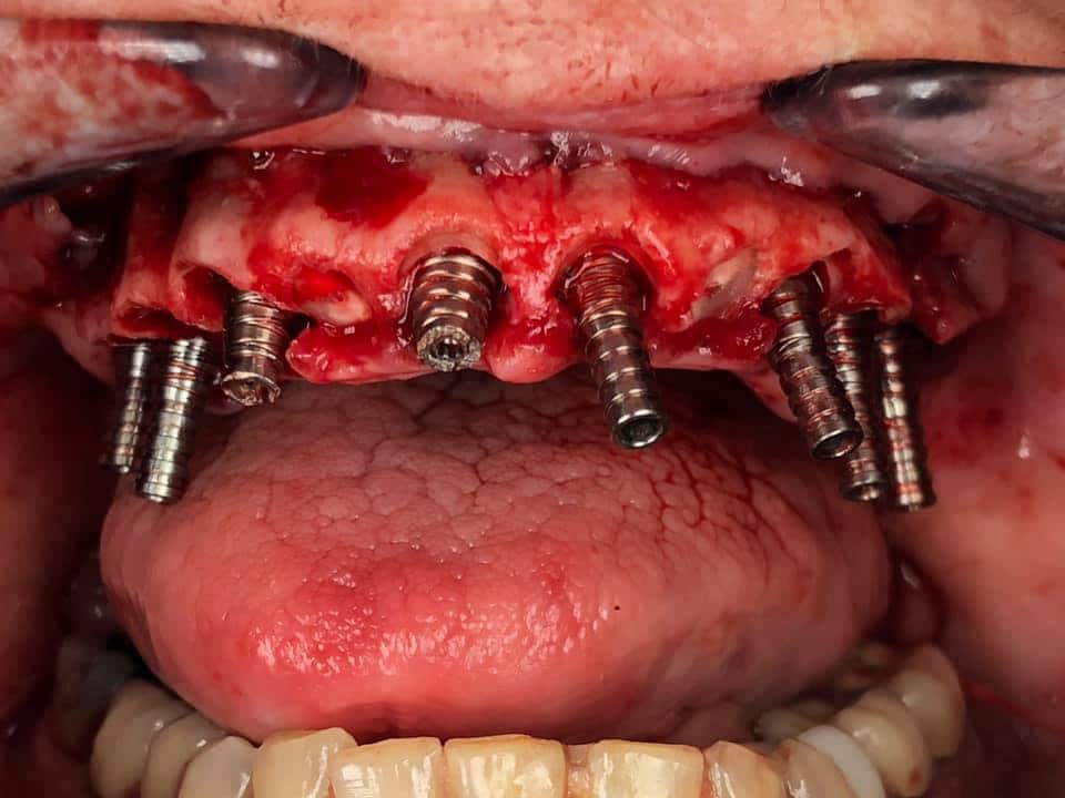 115813937_10105224299559181_8095770600395905986_n