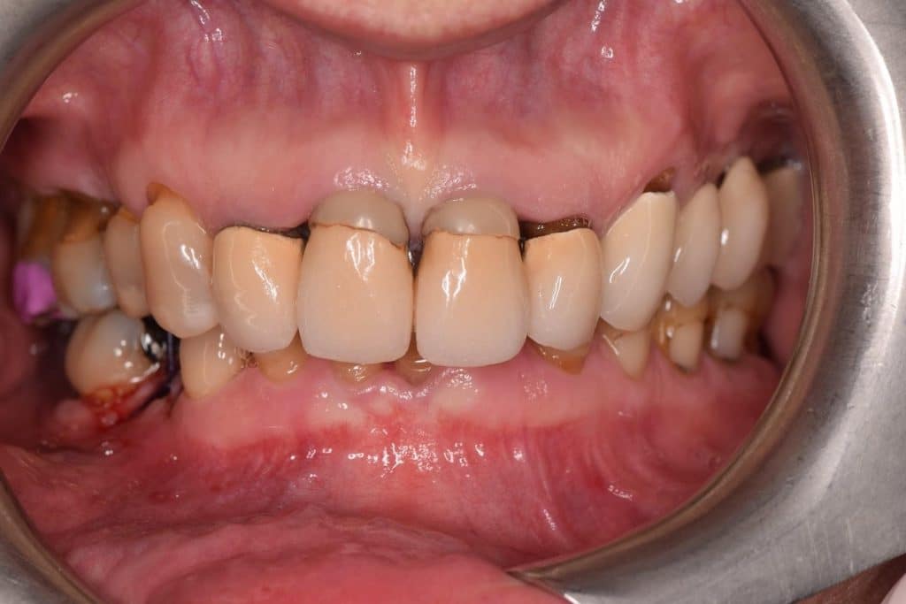 1EDED629-BA1C-4EE5-81D3-6453A852BCE0