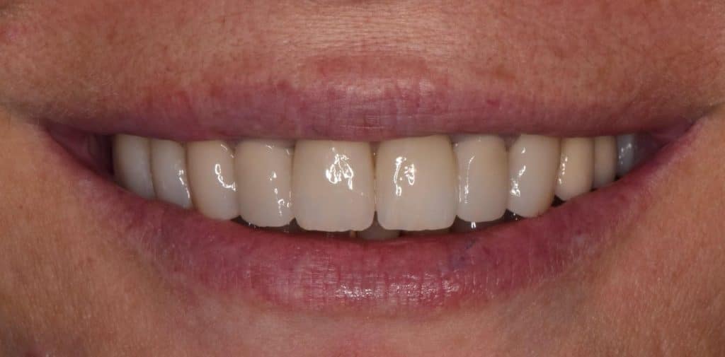 349B1850-F421-45C8-A18F-47ADB1CC6518