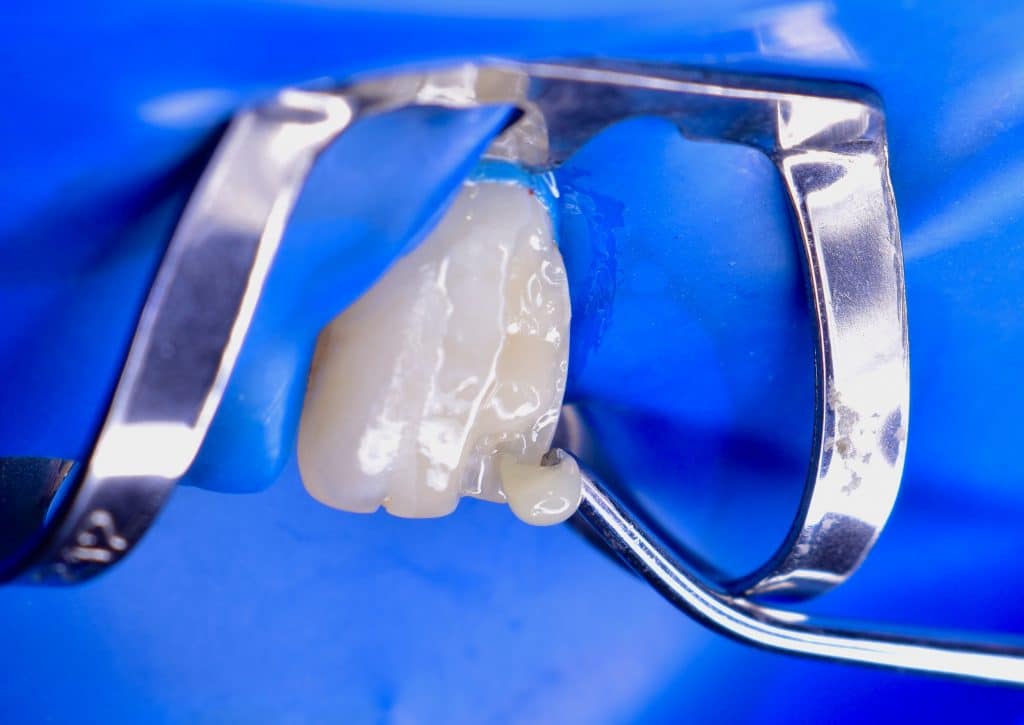 35B937FD-A115-4B4E-B72F-C07E7620AEA6