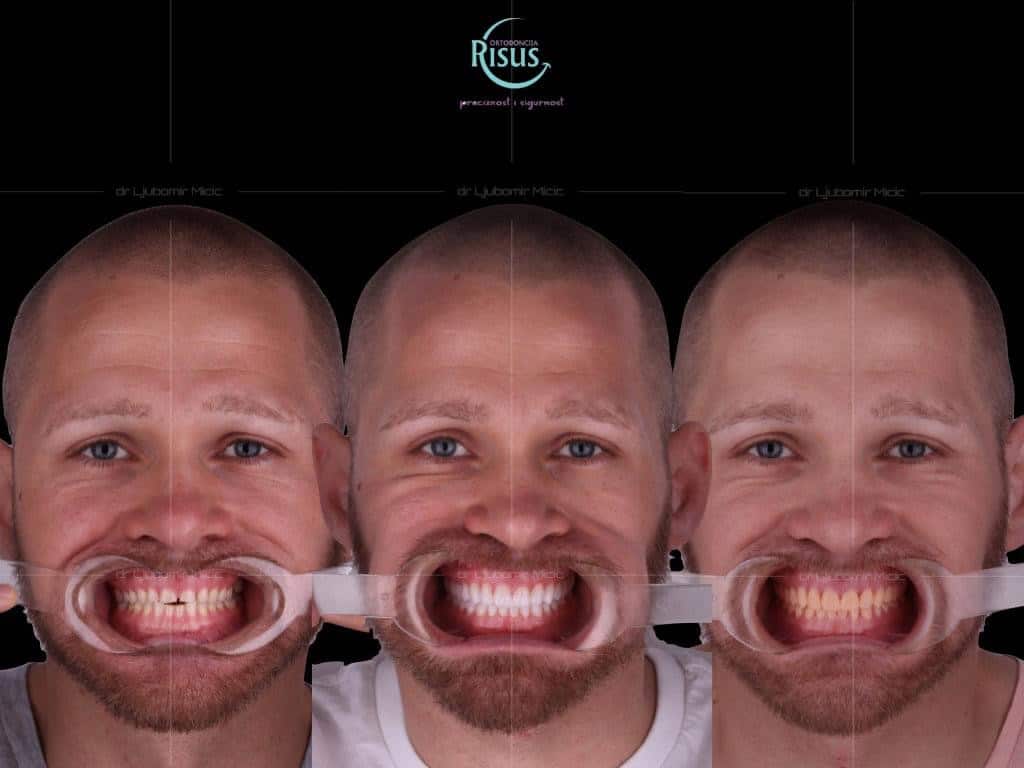 61DD26B5-2B7C-43B3-8F41-0061092F5916