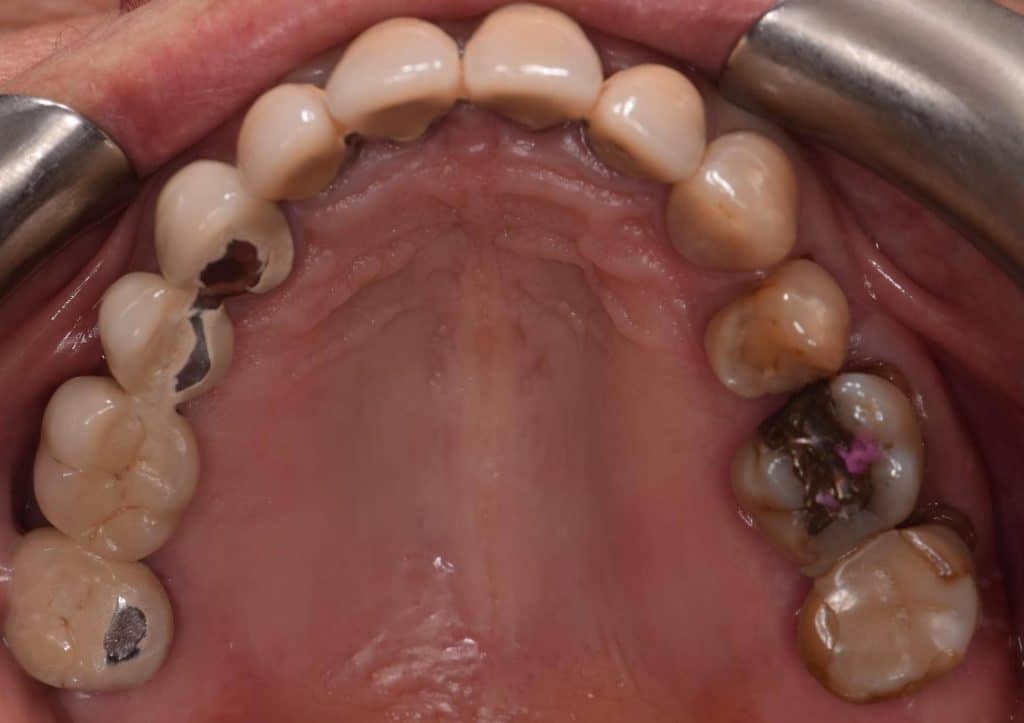 666AA665-2203-4EA6-8958-316C3EE86005