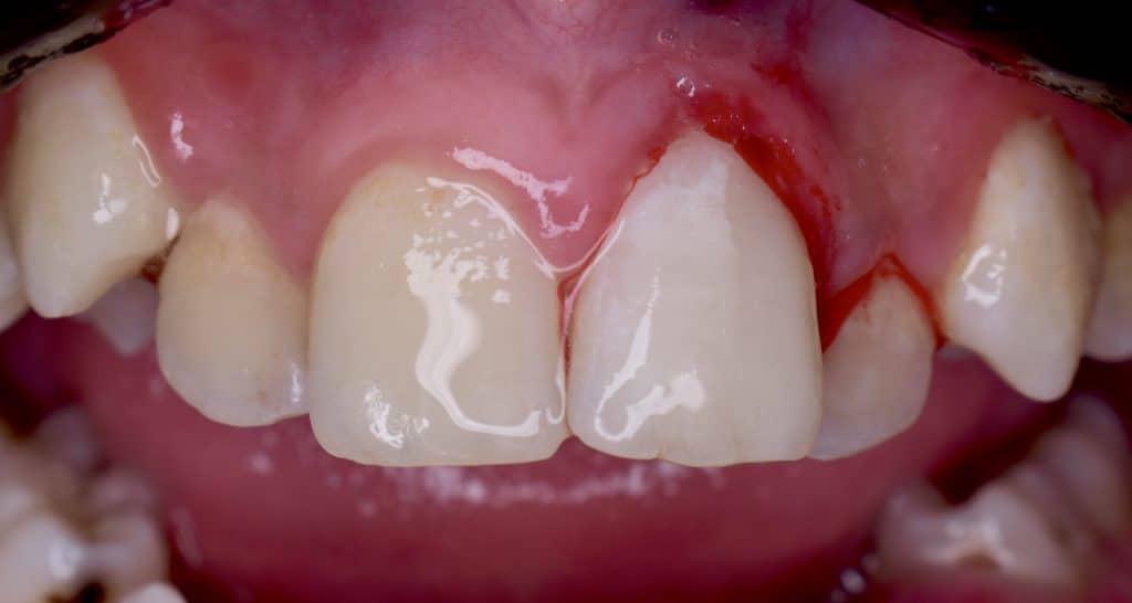 76B0F689-46DD-42A4-93FA-2FD7C9A40BA0