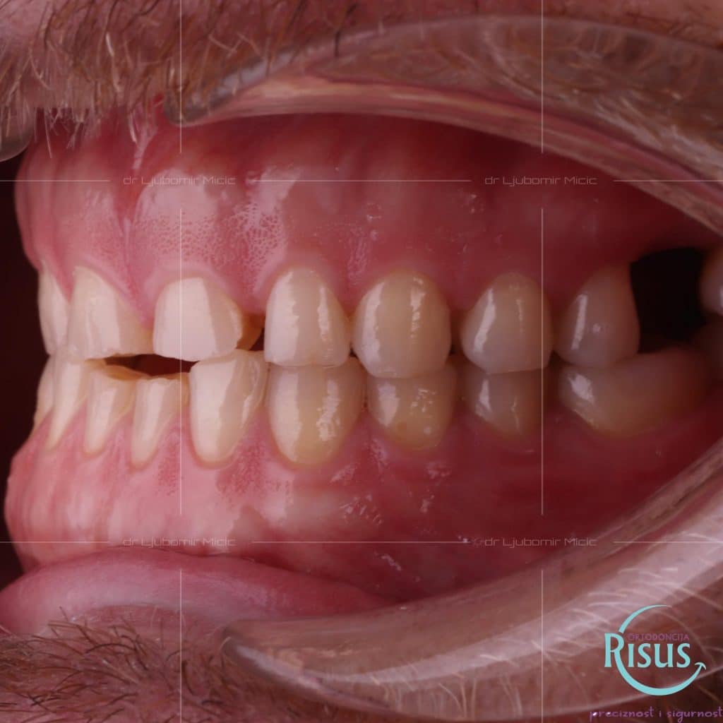 825862DF-F90E-45D3-9B6C-D201C6E7AB0C