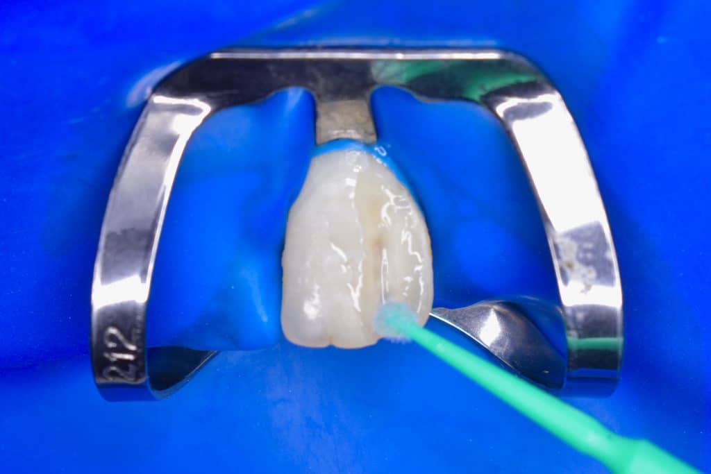 A8332C41-F6B4-4575-9A4C-ACBF32A86862