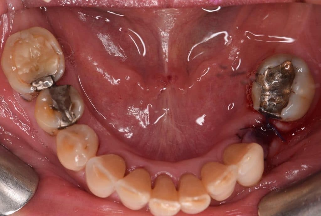 C8A09CB9-F79F-46B7-A737-B34AB9E70E8E