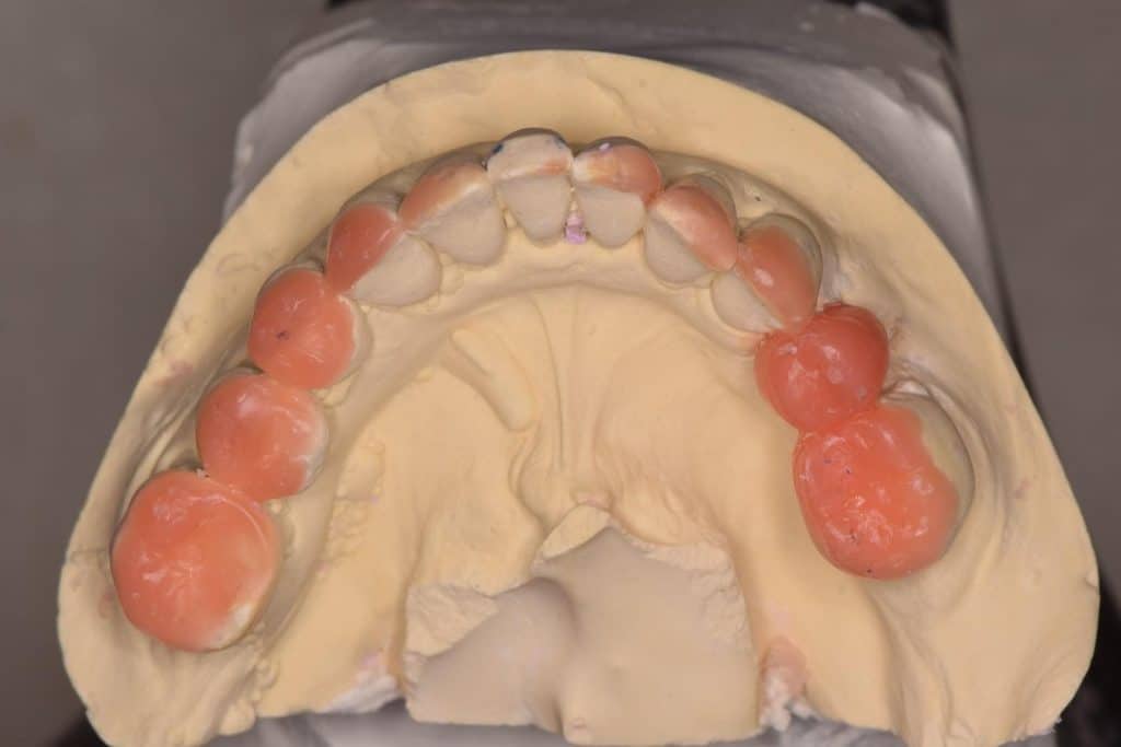 CB194D44-7817-4D5E-8DB0-BE1D3499C0F6