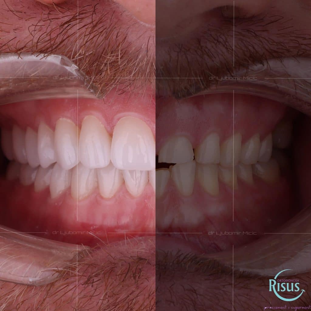 D402084E-F6B3-41CD-AC64-A660CA6AA976