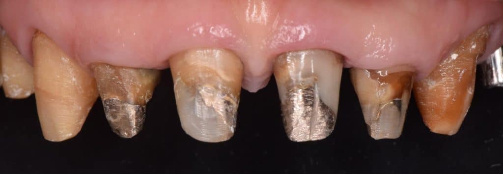 F6A9D7C4-BB45-463E-8C53-D46780788F76