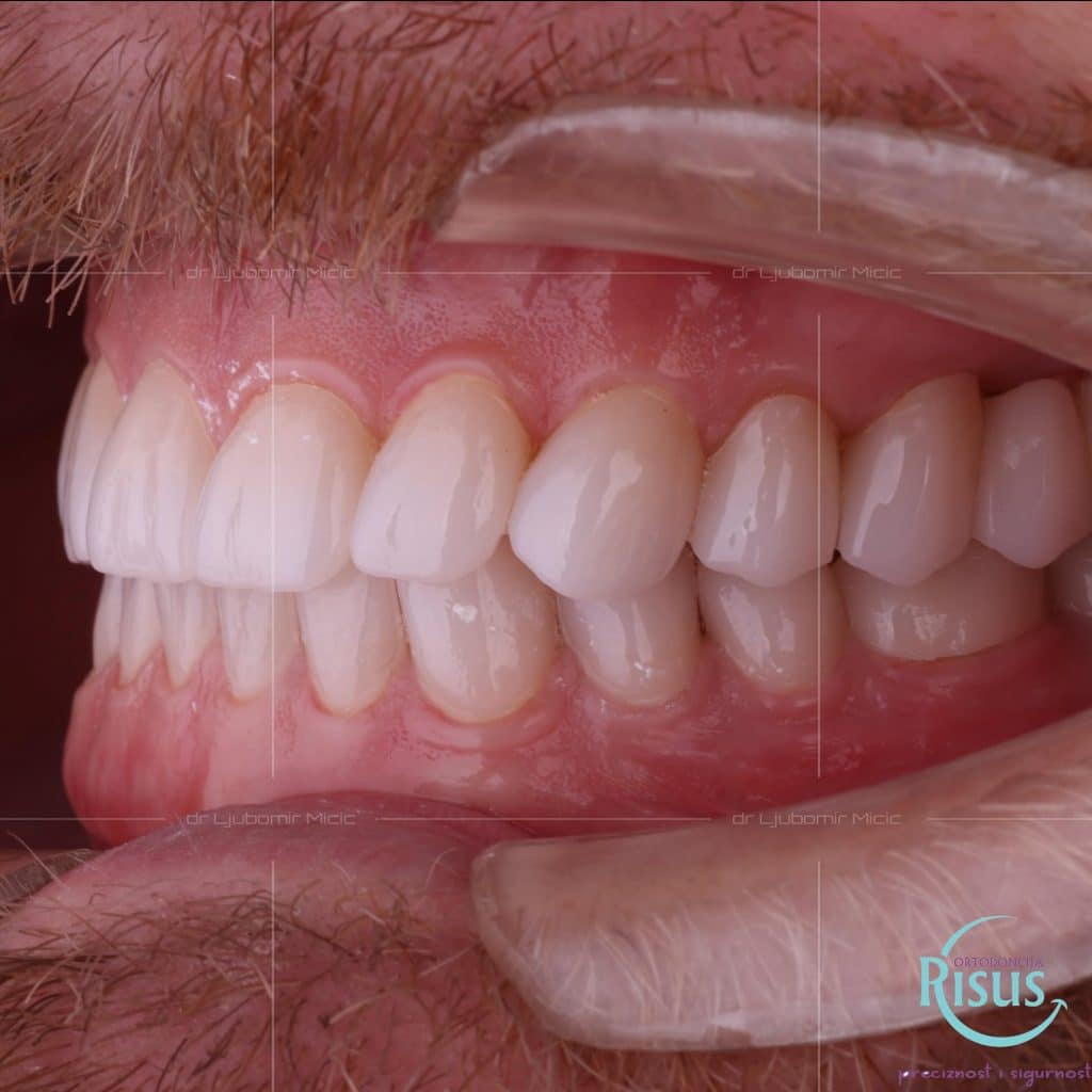 F7CD37C0-C805-420D-B665-B2F225D9DC97