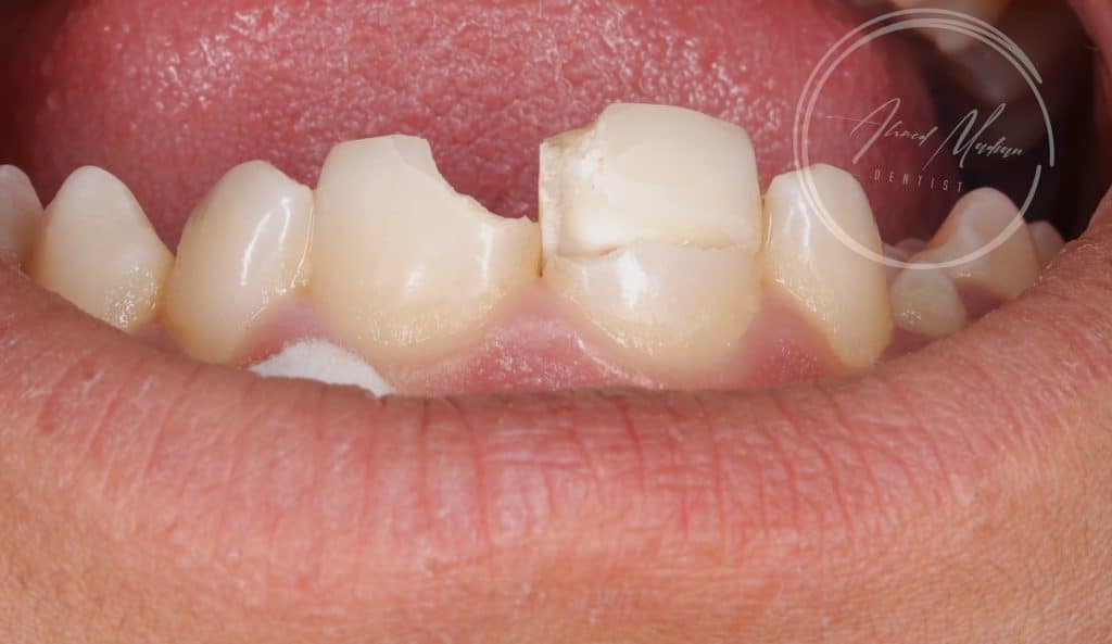 IMG_20220129_005124-01