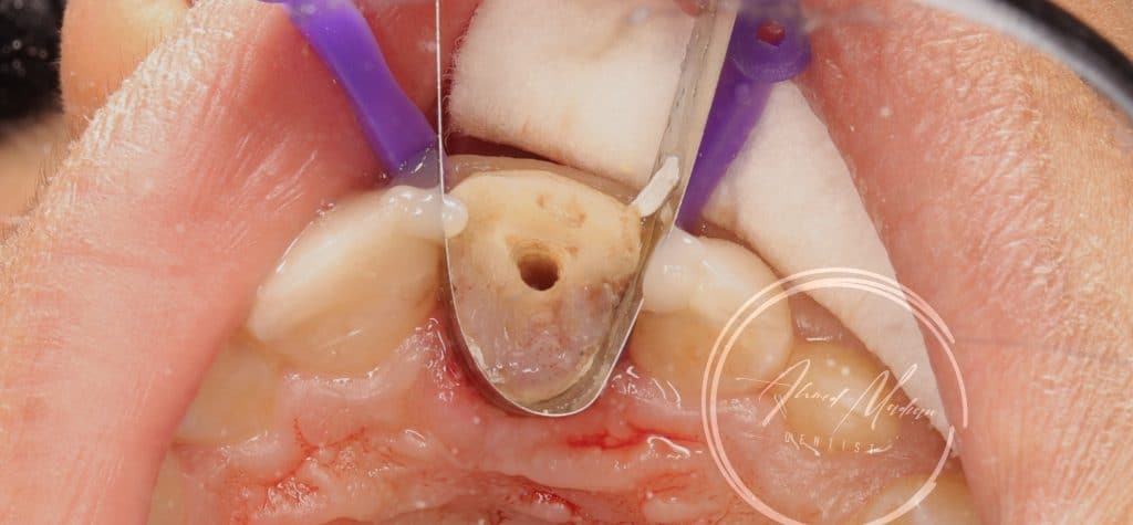 IMG_20220130_200134-01