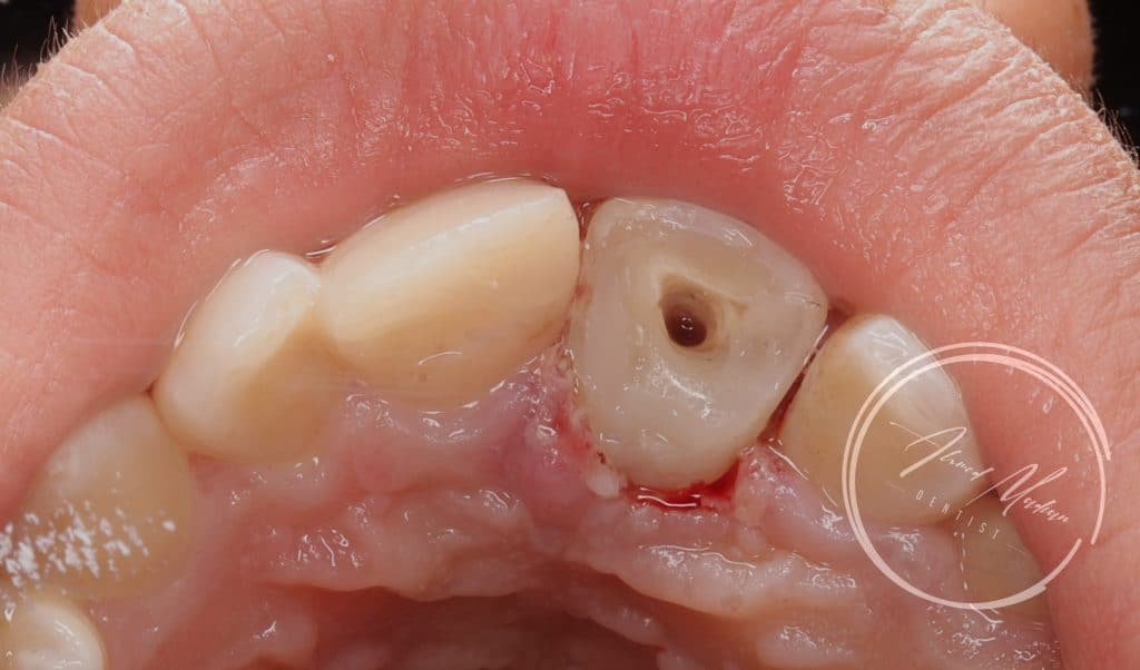 IMG_20220130_200158-01