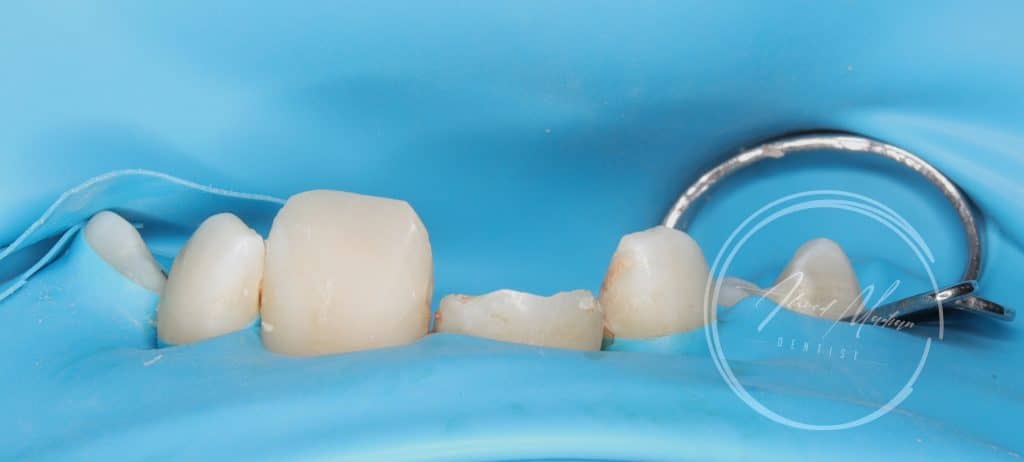 IMG_20220130_200222-01