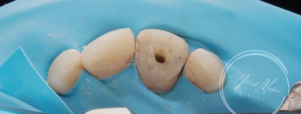 IMG_20220130_200248-01