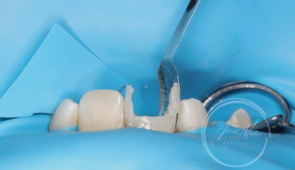 IMG_20220130_200315-01