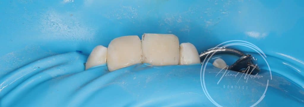 IMG_20220130_200337-01