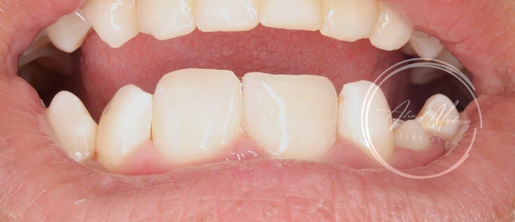 IMG_20220130_200502-01