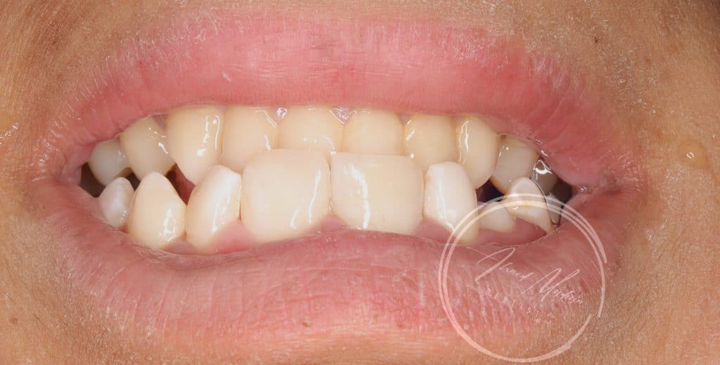 IMG_20220130_200533-01