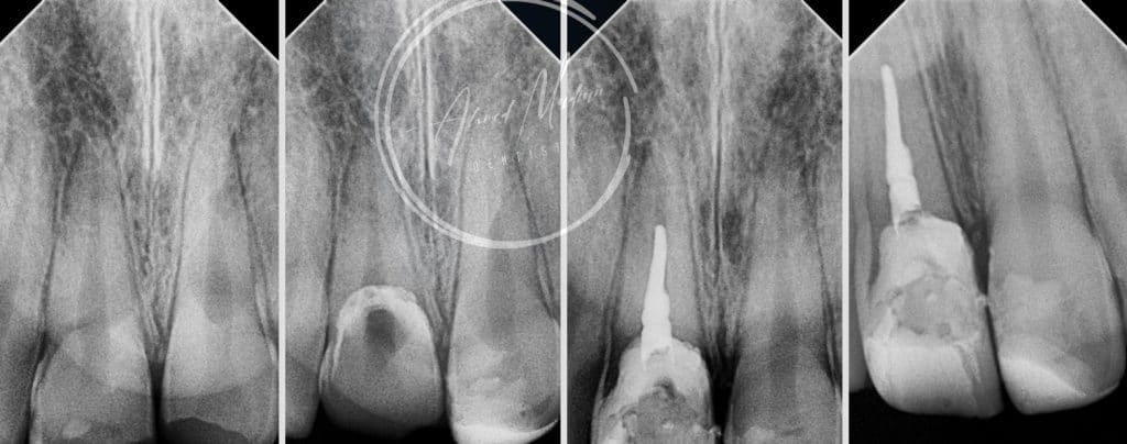 IMG_20220130_224818-01