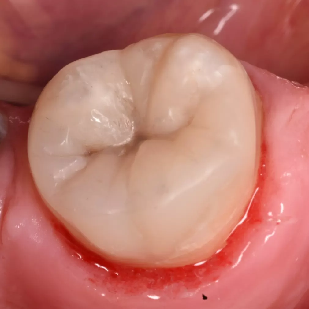 IMG_20220222_213153_975