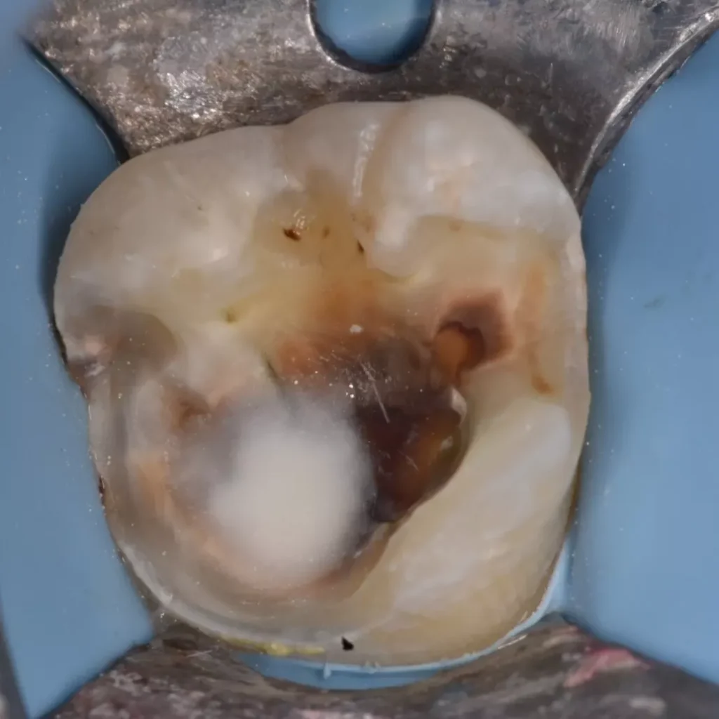 IMG_20220222_213154_004