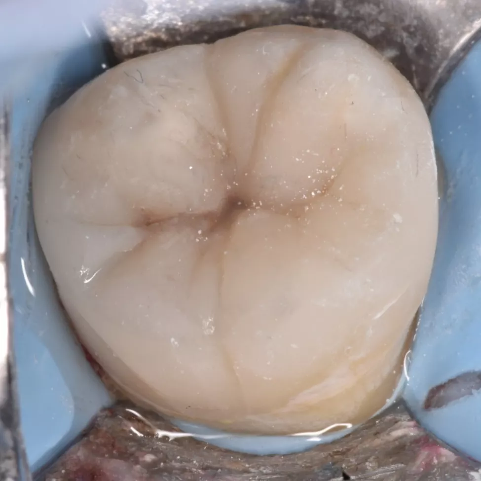 IMG_20220222_213154_025