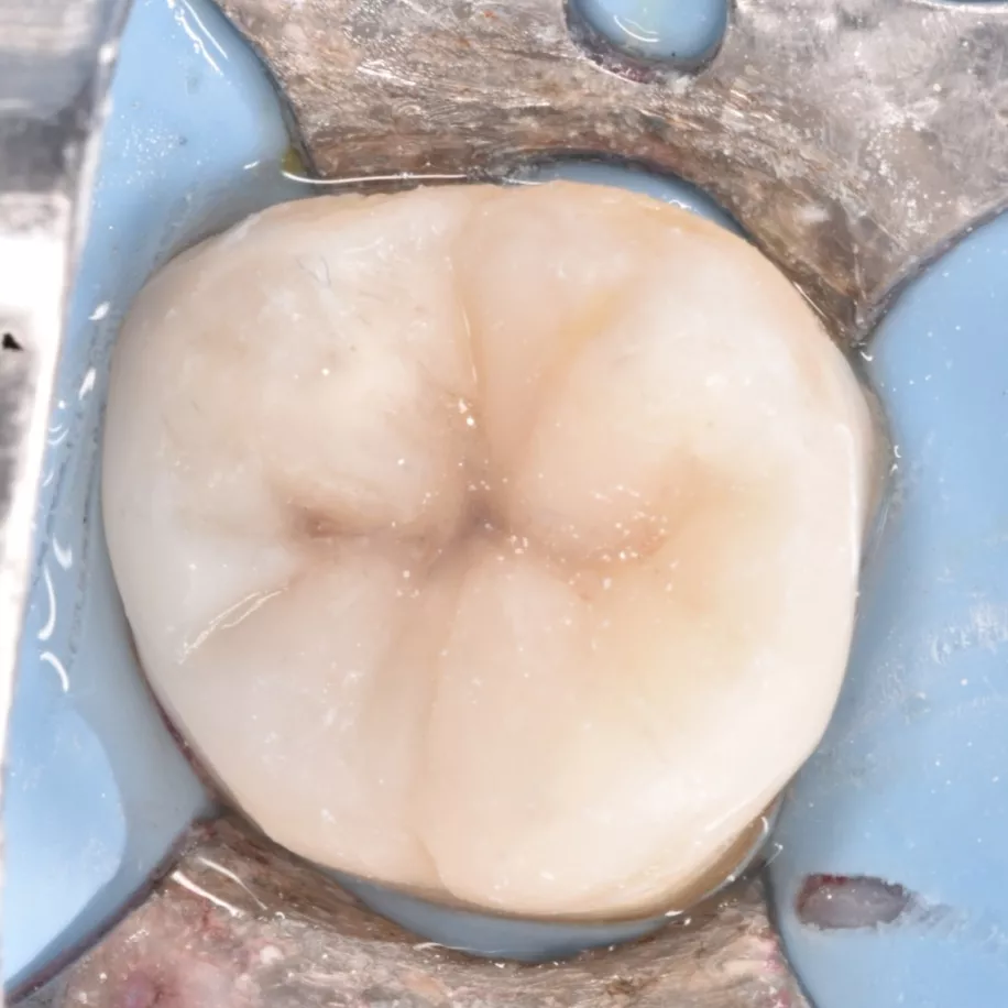 IMG_20220222_213154_027