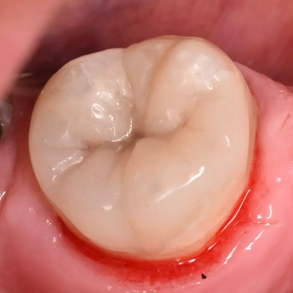 IMG_20220222_213154_029