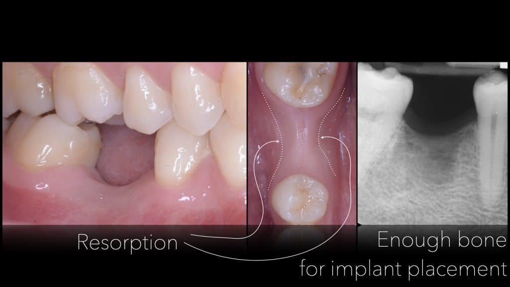 Presentazione Busato_finale.002