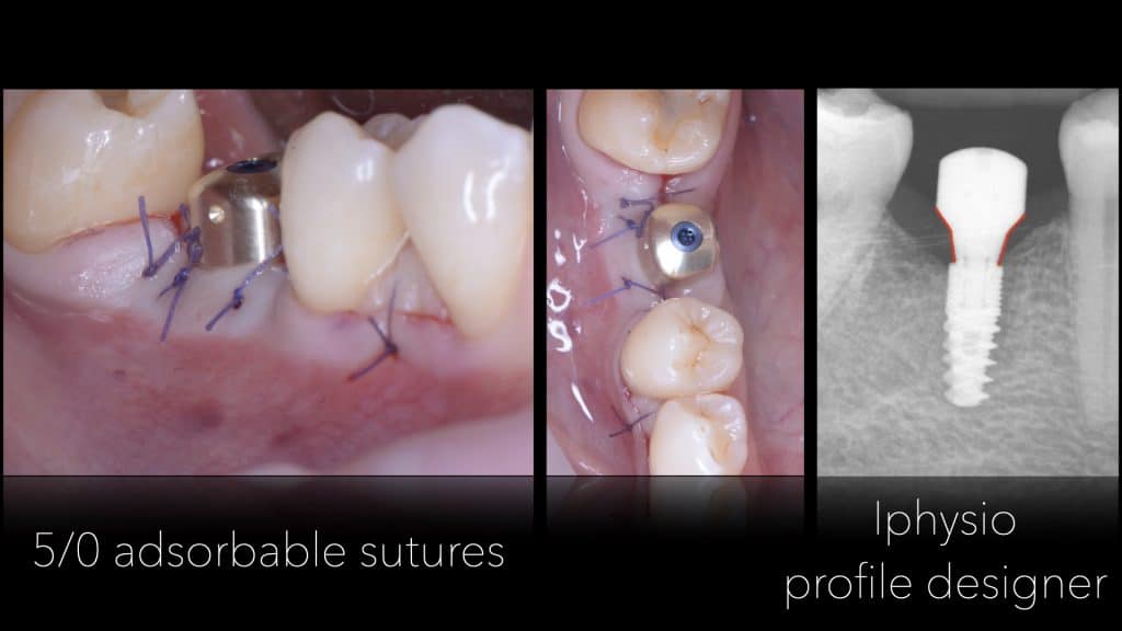 Presentazione Busato_finale.004