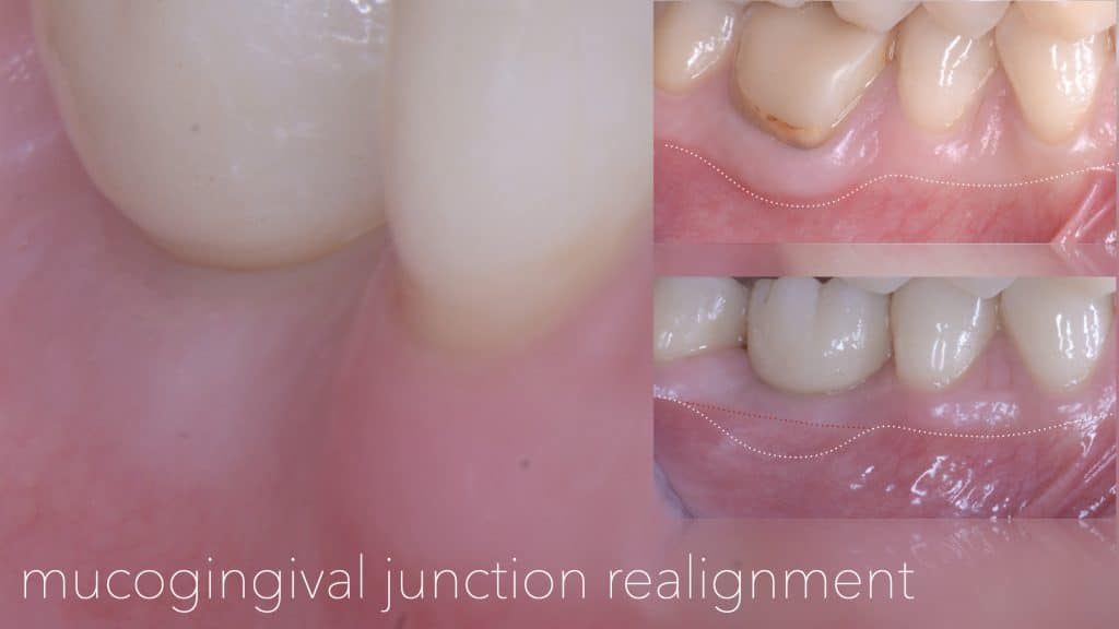 Presentazione Busato_finale.011