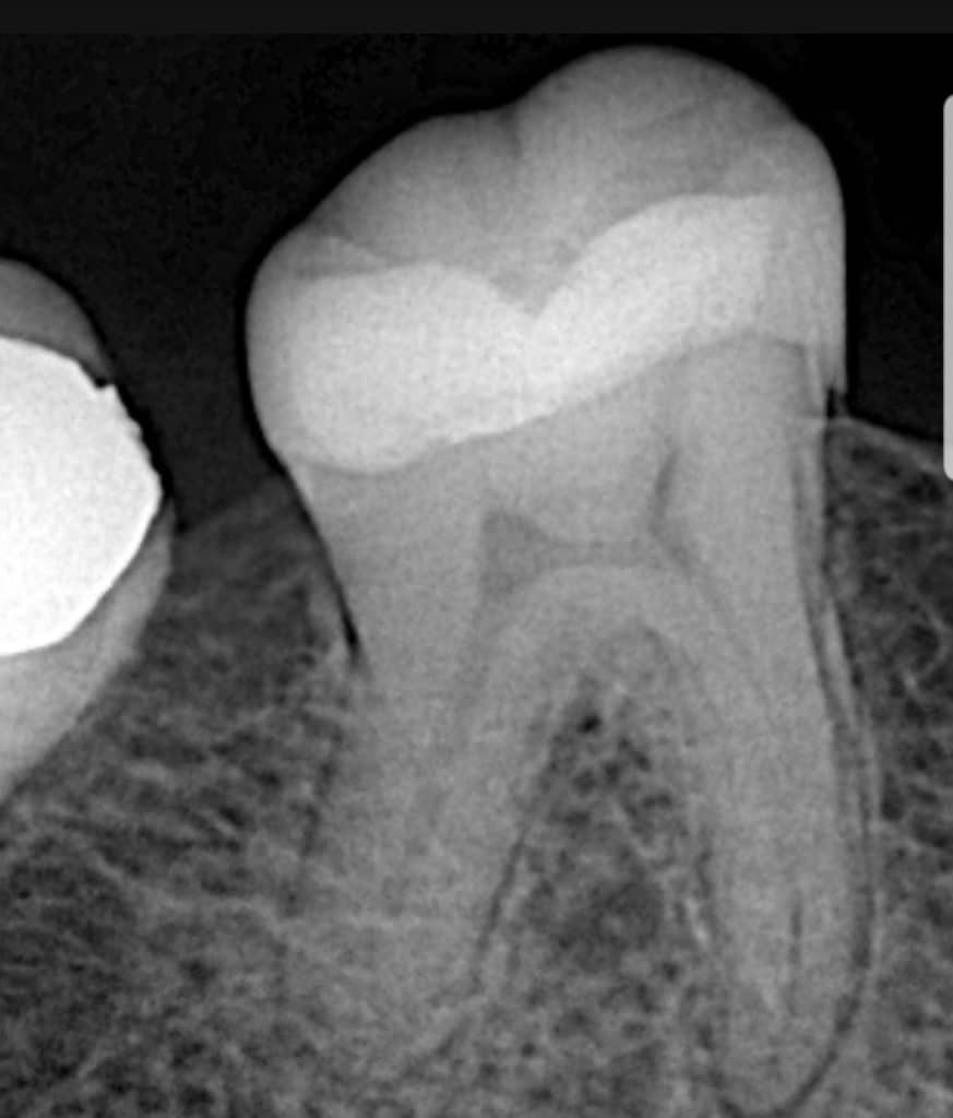 SmartSelect_٢٠٢٢٠٢٢٣-٠٠٢٨٤٥_Instagram