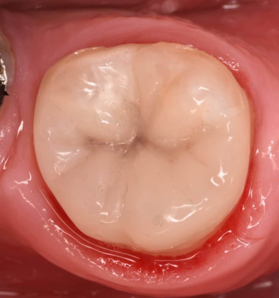 ٢٠٢٢٠٢١٥_٢١٥٦٥٥