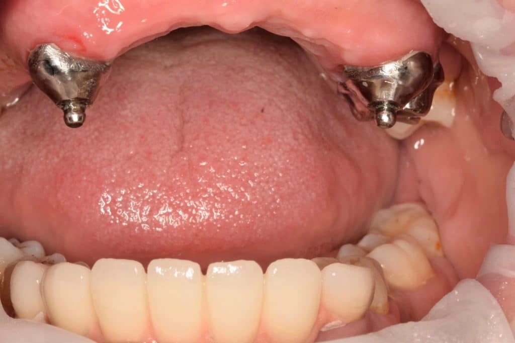 C21F992D-B2E4-4598-A334-7302AE26DEBF