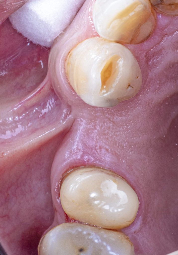 FB_IMG_1646152449474