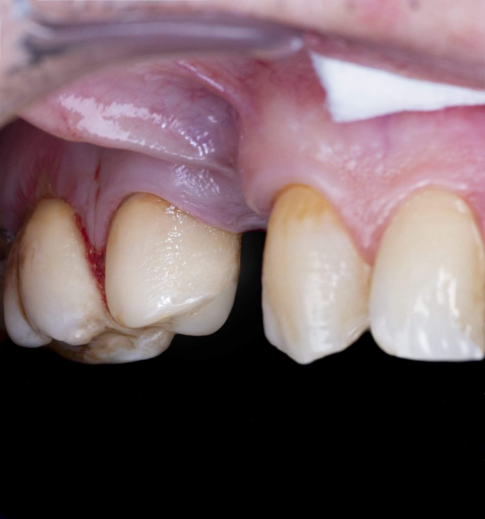 FB_IMG_1646152452877