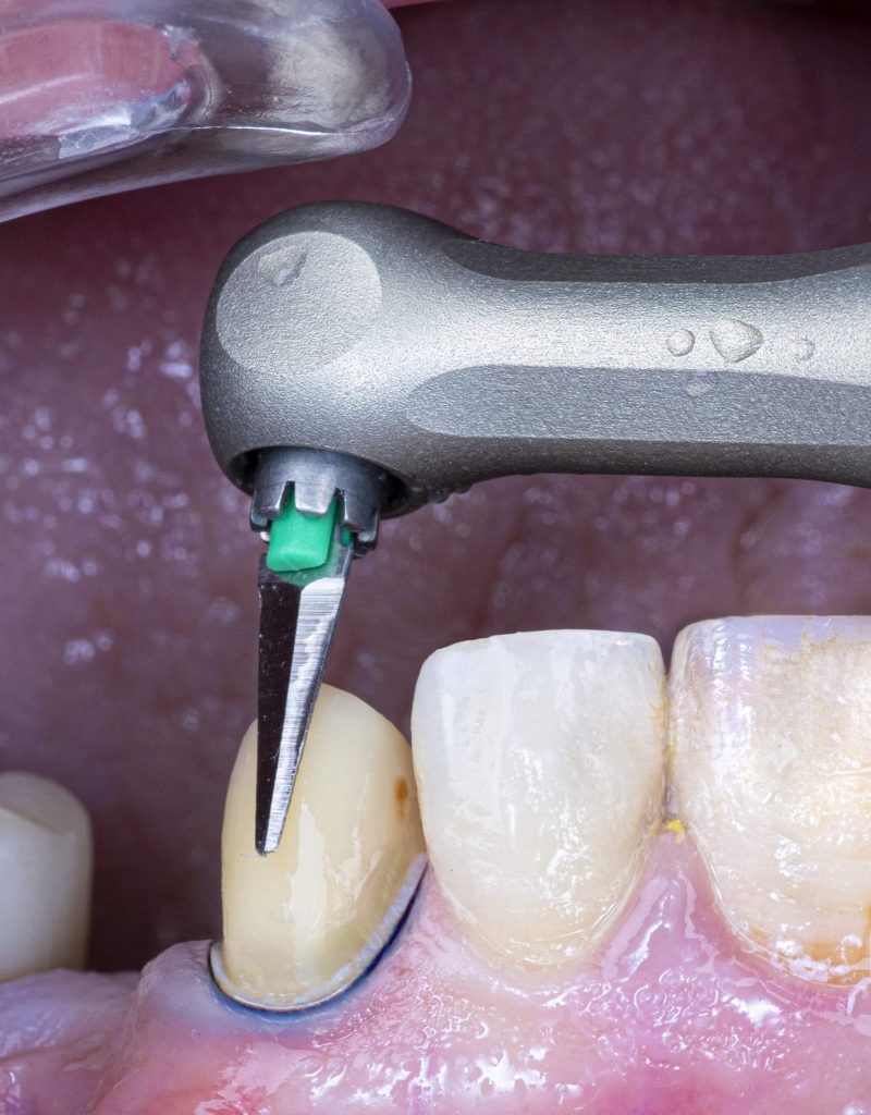 FB_IMG_1646152472374