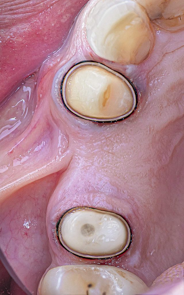 FB_IMG_1646152477200