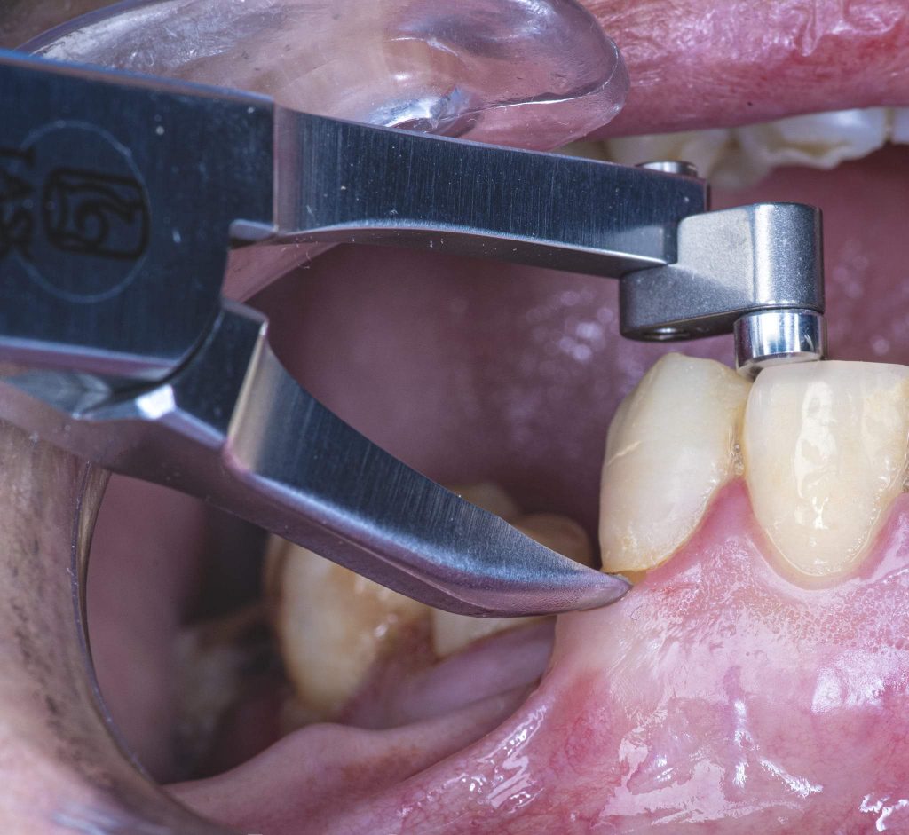 FB_IMG_1646152487596