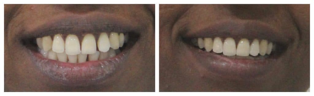 FotoJet - 2022-03-11T134809.296