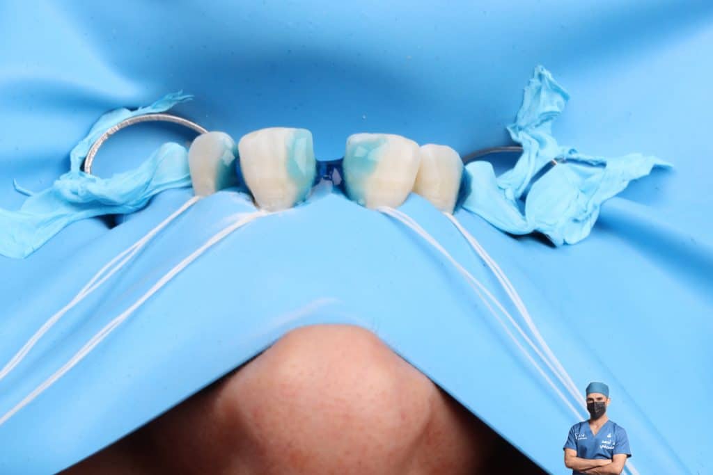 0BA80B09-AC06-48EF-8CFF-5E2A4B863C80