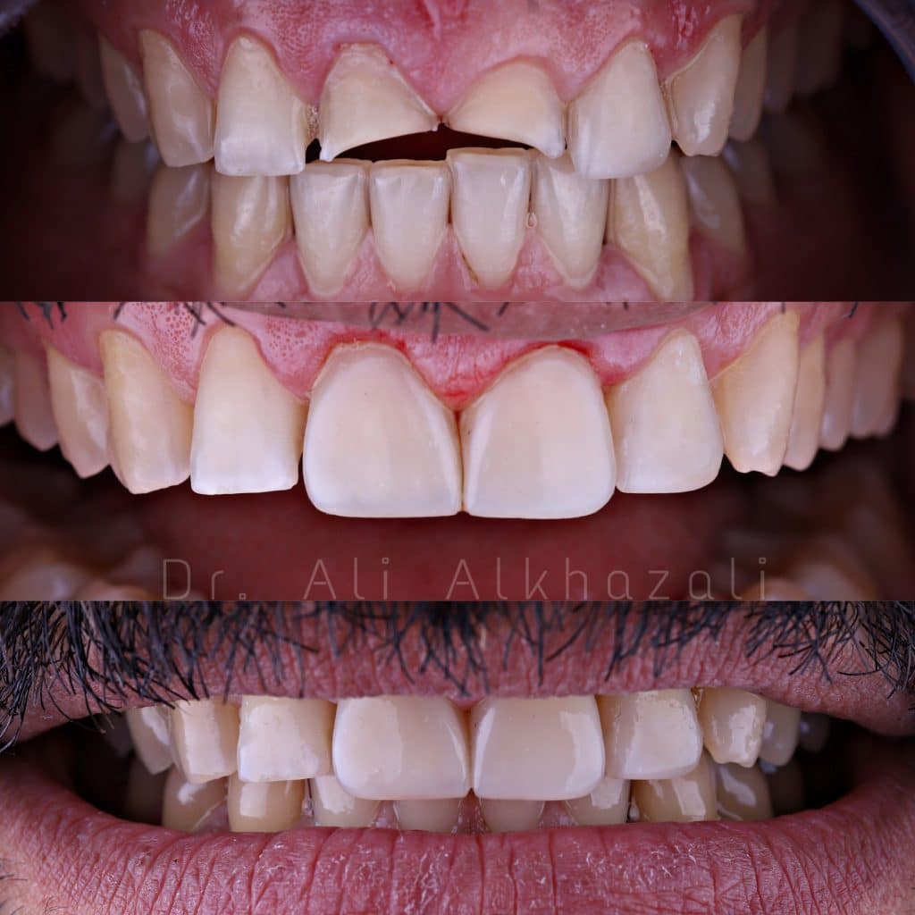 13D6C867-B30A-47F6-BF4D-6F99DA50CD85