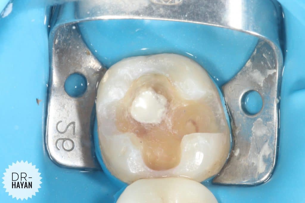 166326D0-7B6A-417F-B832-E5542728C9D5