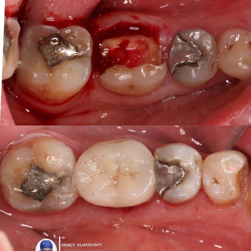 1AA82F9B-D548-4CDE-AC15-4A0D468B2B62