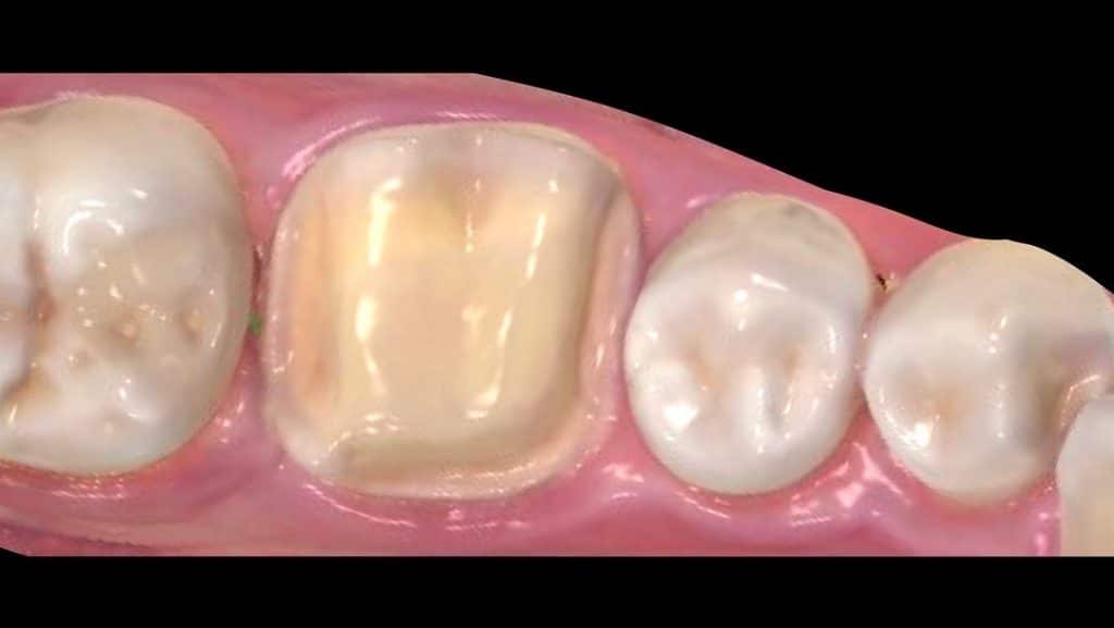 1C1163BA-1EBF-41FA-93DB-E24A72D60A75