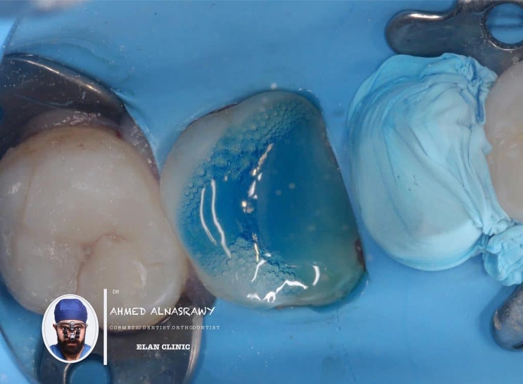 1C39FB9A-D56B-415E-9C66-0C5D83400D3F