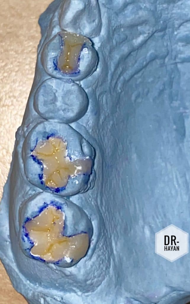 1EE21CA3-1275-4657-BCC9-99565BB4A98F